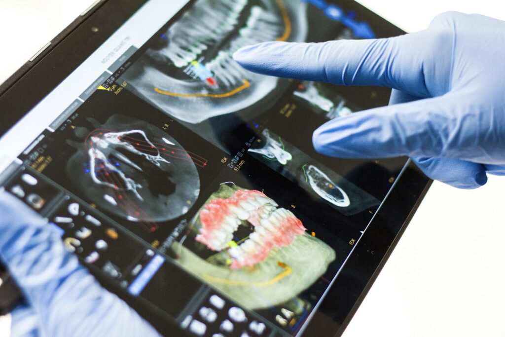 A 3D dental scan reviewed on a tablet