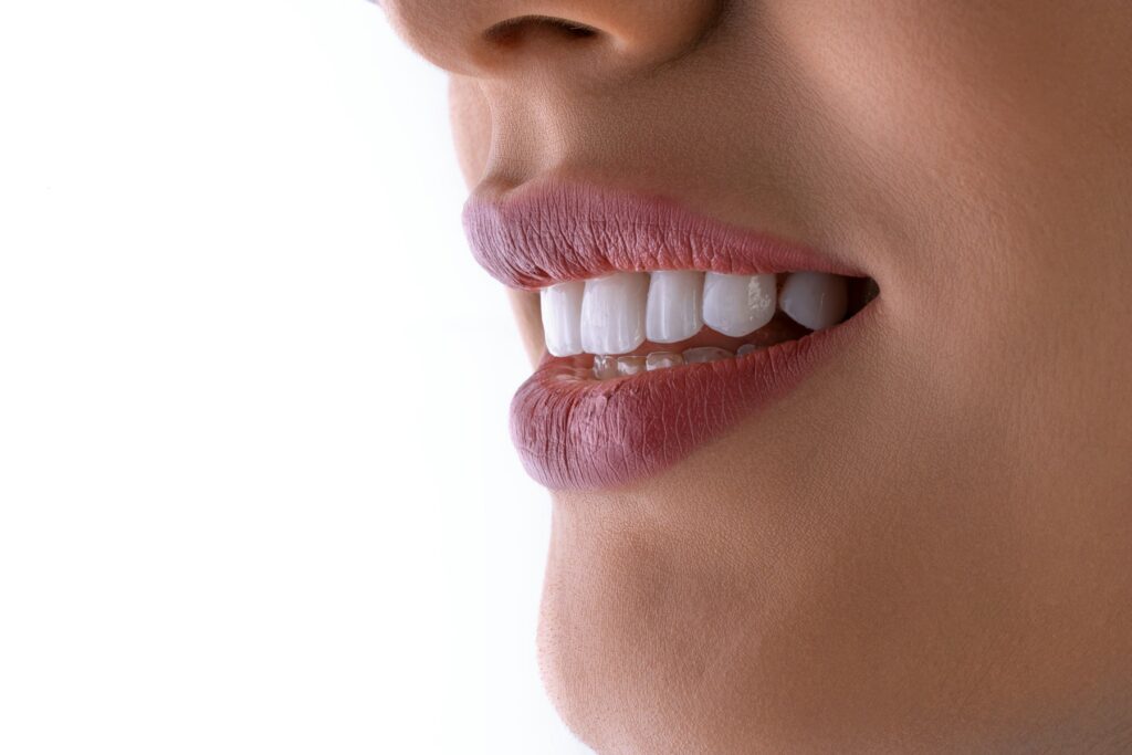 Teeth whitening After