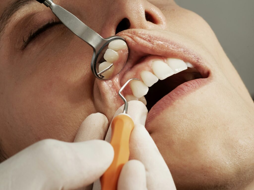 Close-up of a dental examination