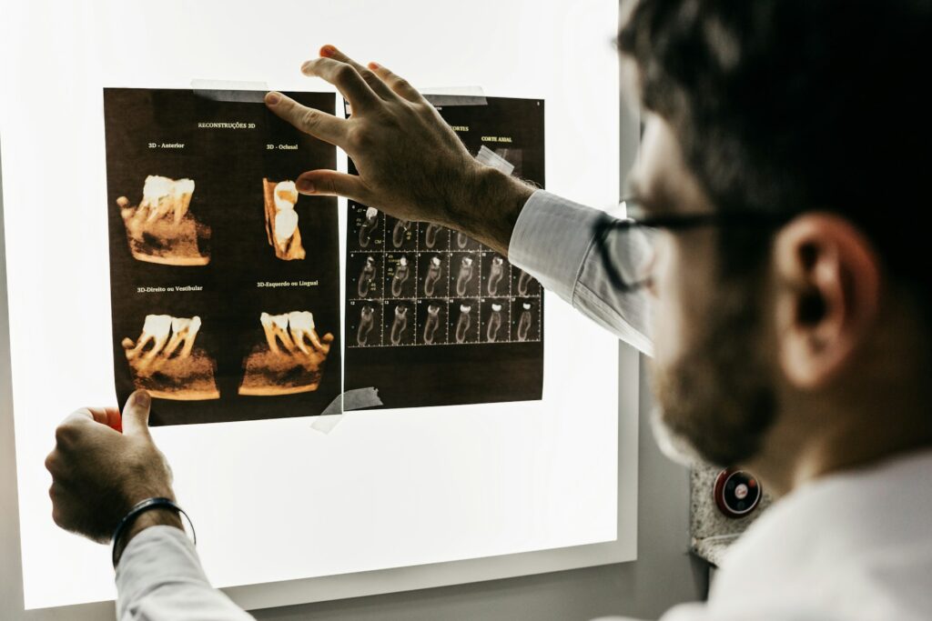Reviewing dental scans on a light board